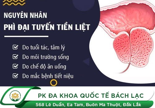 Phì đại tuyến tiền liệt