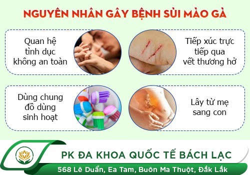 Nguyên Nhân Và Triệu Chứng Của Bệnh Sùi Mào Gà Ở Cổ Tử Cung