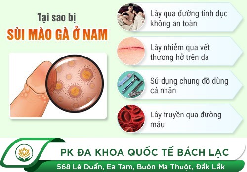 Nguyên Nhân Sùi Mào Gà Và Cách Trị
