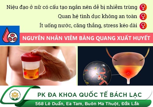 Đau bụng dưới và đi tiểu buốt, tiểu nhiều lần khiến bạn mệt mỏi