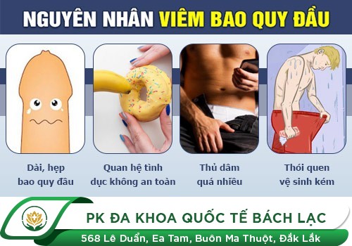 Cách Điều Trị Chứng Viêm Bao Quy Đầu Hiệu Quả