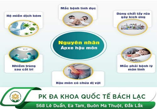 Nguyên Nhân Gây Áp Xe Hậu Môn Và Cách Hỗ Trợ Điều Trị