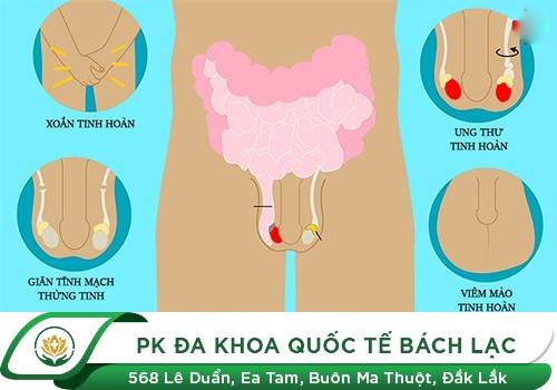 Cảnh báo bệnh lý tinh hoàn không nên bỏ qua