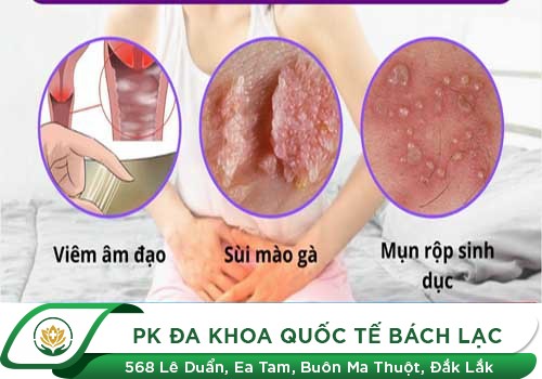 Bạn Biết Gì Về Ngứa Vùng Kín