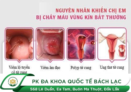 Những Điều Cần Biết Về Xuất Huyết, Chảy Máu Tử Cung Bất Thường