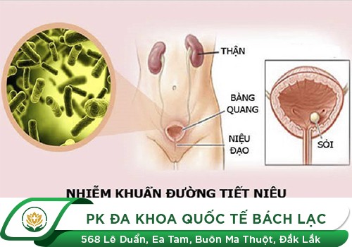 Khám bệnh nhiễm trùng đường tiểu ở đâu
