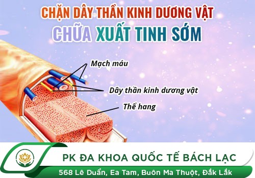 Kỹ Thuật Chữa Xuất Tinh Sớm Hiệu Quả Nhất Hiện Nay