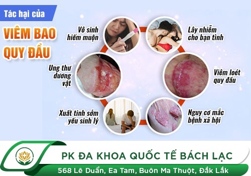 Nguyên Nhân Và Tác Hại Viêm Bao Quy Đầu