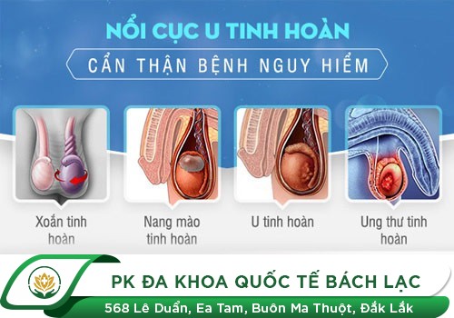 Các bệnh tinh hoàn. Nhận biết bệnh tinh hoàn qua những triệu chứng nào?