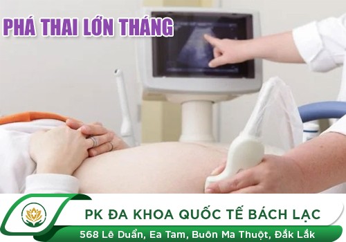 Thai lớn tháng và phương pháp an toàn hiện nay