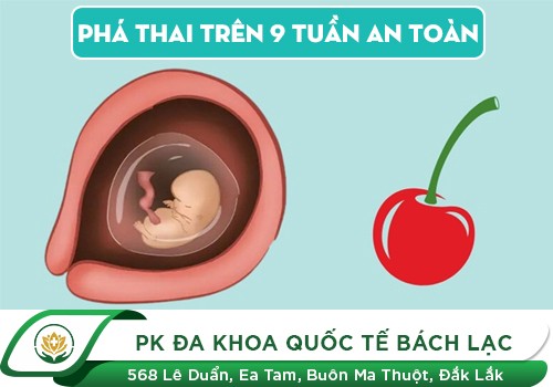 Phương pháp an toàn đình chỉ thai lớn trên 9 tuần mới năm 2026