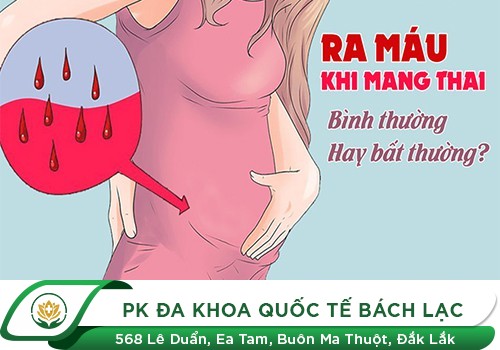 Mang Thai Vẫn Có Kinh Là Tại Sao