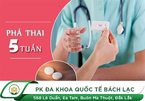 Phá thai 5 tuần tuổi có thực hiện được không bác sĩ?