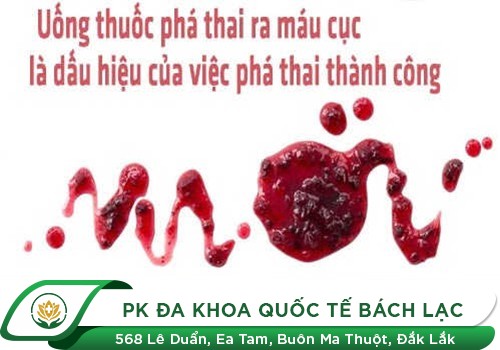 Dấu Hiệu Nào Cho Bạn Biết Đã Phá Thai Thành Công