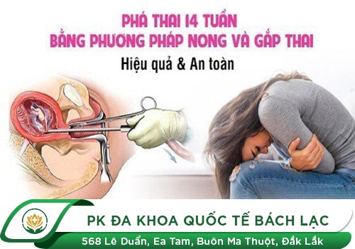 Phương pháp phá thai trên 14 tuần tuổi