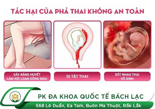Phá thai bao nhiêu lần thì vô sinh