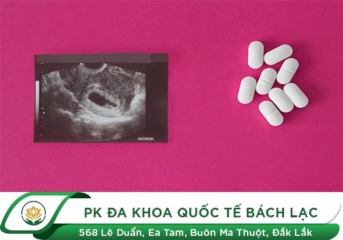 Thuốc tiêu thai ở đâu hiệu quả nhất
