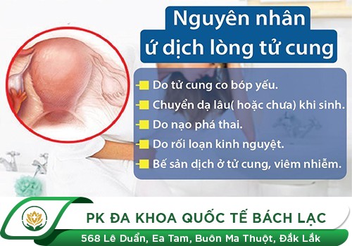 Làm Cách Nào Hết Ứ Dịch Tử Cung