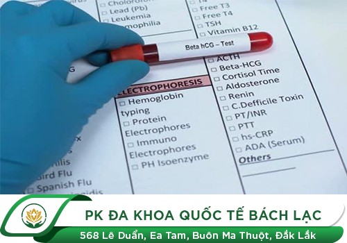 Địa chỉ xét nghiệm beta HCG uy tín