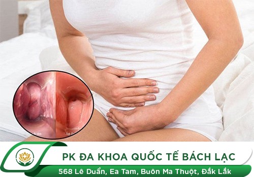 Cách chữa viêm âm đạo hiệu quả, giảm khả năng tái phát