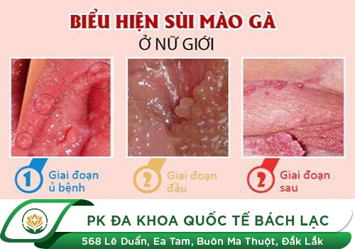 Bệnh xã hội