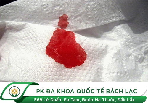 Tự nhiên ra máu vùng kín kèm đau bụng dưới là dấu hiệu gì?