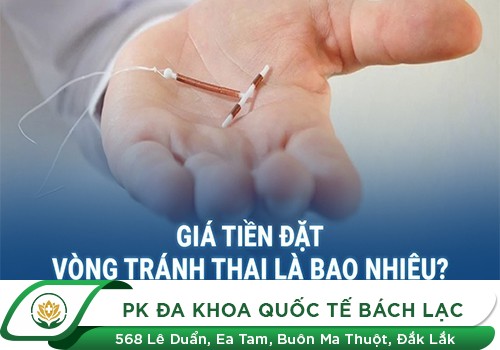 Đặt Vòng Tránh Thai Bao Nhiêu Tiền