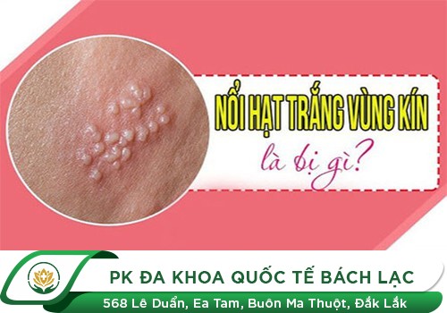 Chuỗi Hạt Ngọc Âm Vật Ở Nữ Giới Có Chữa Được Không?