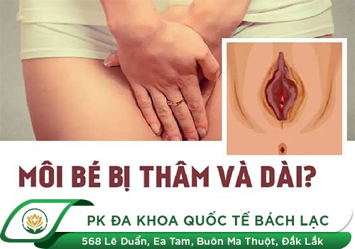 Tại Sao Môi Bé To Dài? Cách Khắc Phục Hiệu Quả Nhất Hiện Nay