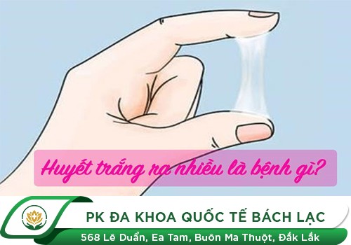 Vì Sao Bị Huyết Trắng Ra Nhiều