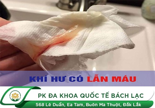 Dịch âm đạo có lẫn máu là bệnh gì