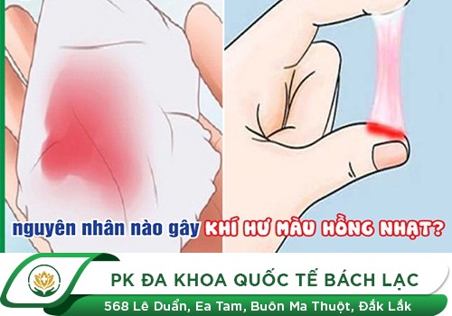 Huyết trắng màu hồng, liệu có phải đã mắc bệnh