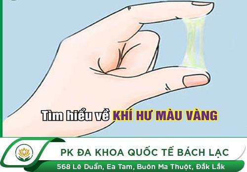 Khí Hư Màu Vàng Có Mùi Cảnh Báo Bệnh Lý Nào?
