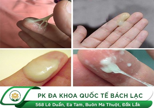 Cách điều trị bệnh khí hư hiệu quả