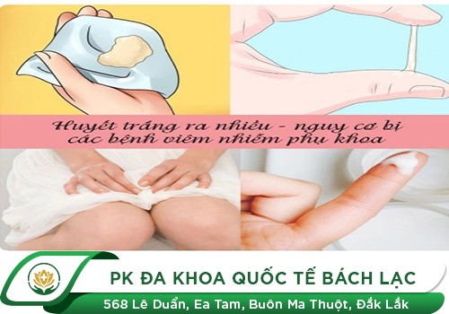 Khí hư ra nhiều nguyên nhân và cách điều trị