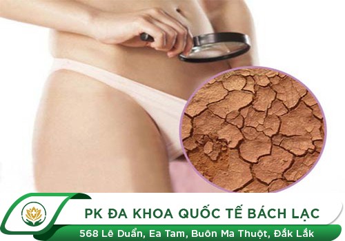 Tìm Hiểu Về Tình Trạng Khô Âm Đạo Ở Nữ Giới