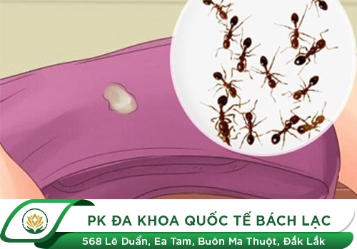Kiến Bu Quần Lót, Khí Hư Bị Kiến Bu Có Sao Không