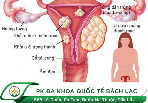  Nguyên nhân kinh nguyệt không đều