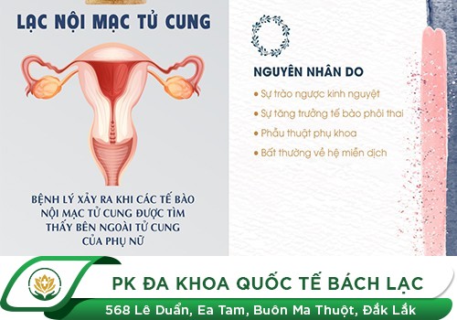 Lạc Nội Mạc Tử Cung Là Bệnh Gì