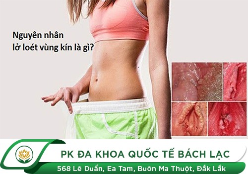 Lở loét âm đạo - Dấu hiệu nguy hiểm chị em cần cẩn trọng