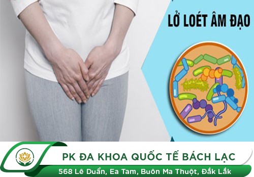 lở loét âm đạo