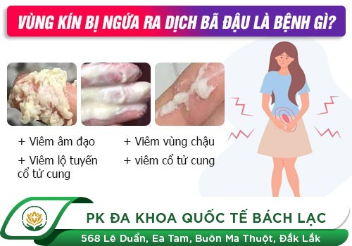 Cảnh Báo 9 Nguyên Nhân Hàng Đầu Khiến Nữ Giới Bị Ngứa Vùng Kín
