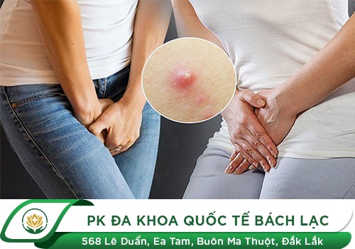 Nổi Mụn Ở Cổ Tử Cung Là Bệnh Gì