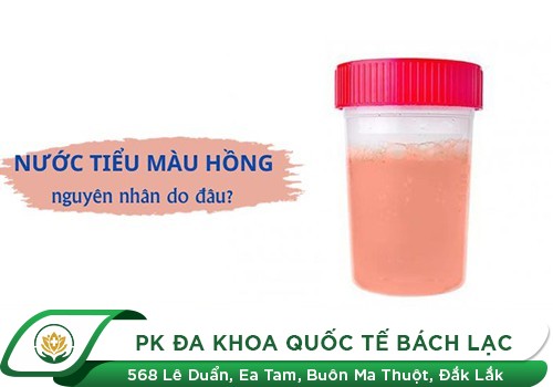 Nước Tiểu Có Màu Hồng Nhạt Là Dấu Hiệu Bệnh Gì?