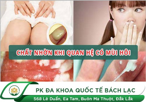 Chất nhờn khi quan hệ có mùi hôi là dấu hiệu của bệnh gì?