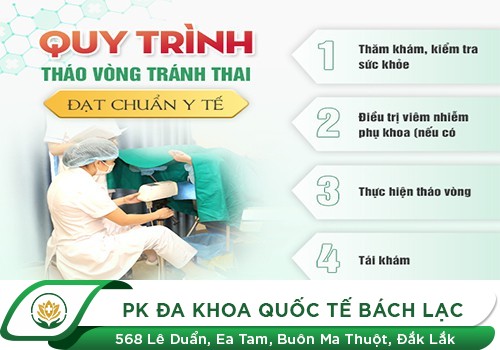 Những Điều Cần Biết Khi Muốn Tháo Vòng Tránh Thai