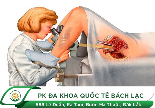 Địa chỉ soi cổ tử cung an toàn, chính xác tại Đắk Lắk