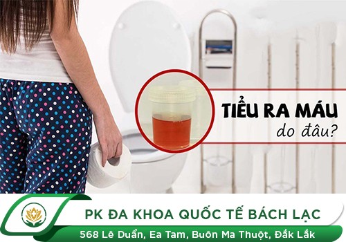 Địa chỉ chuyên khám và điều trị tiểu buốt ra máu