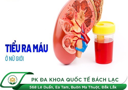 Đái Ra Máu Và Đau Bụng Dưới Là Bệnh Gì? Biểu Hiện, Nguyên Nhân Và Cách Điều Trị