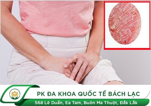 Vùng kín bị khô bong da phải làm sao?